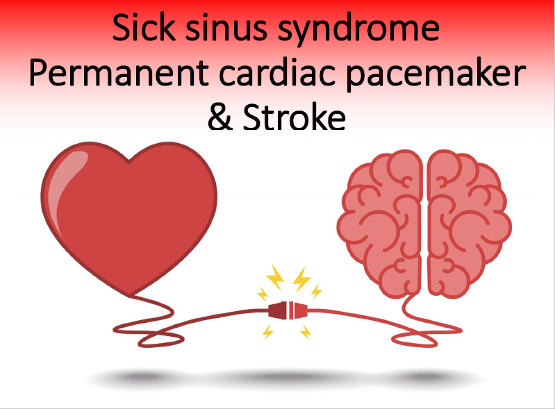 hemorrhagic stroke การ พยาบาล ธนบุรี